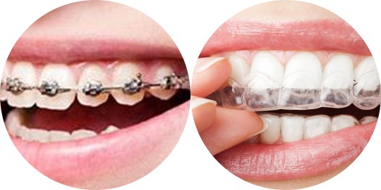 Orthodontic Services